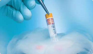 Sperm Freezing
